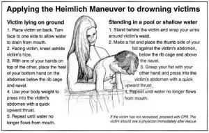 A graphic from the '95/'96 issue of Parameters, a magazine published by the University of Houston's electrical engineering department, illustrates how to perform the Heimlich on a drowning victim. NASCO founder John Hunsucker was the university's industrial engineering professor at the time.